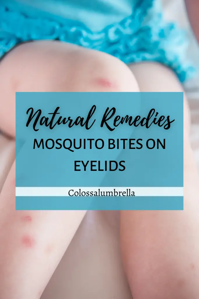 Mosquito bite on eyelid toddler