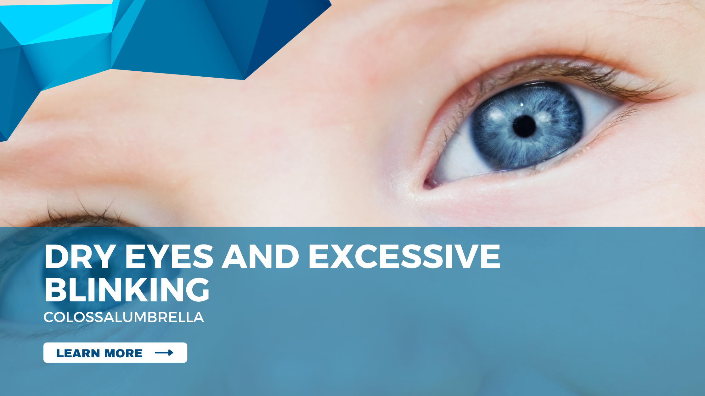 Child dry eyes blinking – Symptoms and Treatments