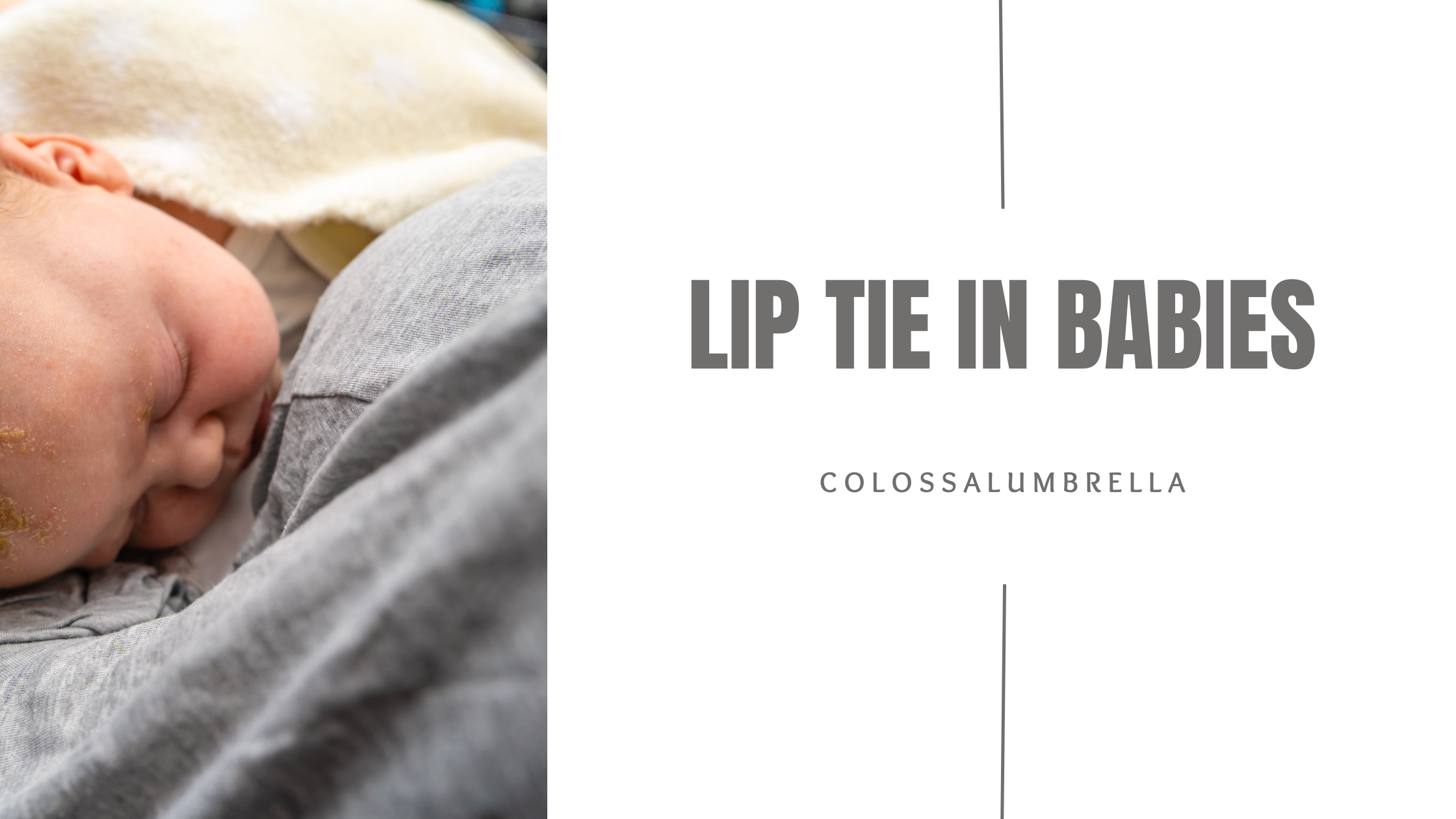 Lip Tie Problems Later in Life